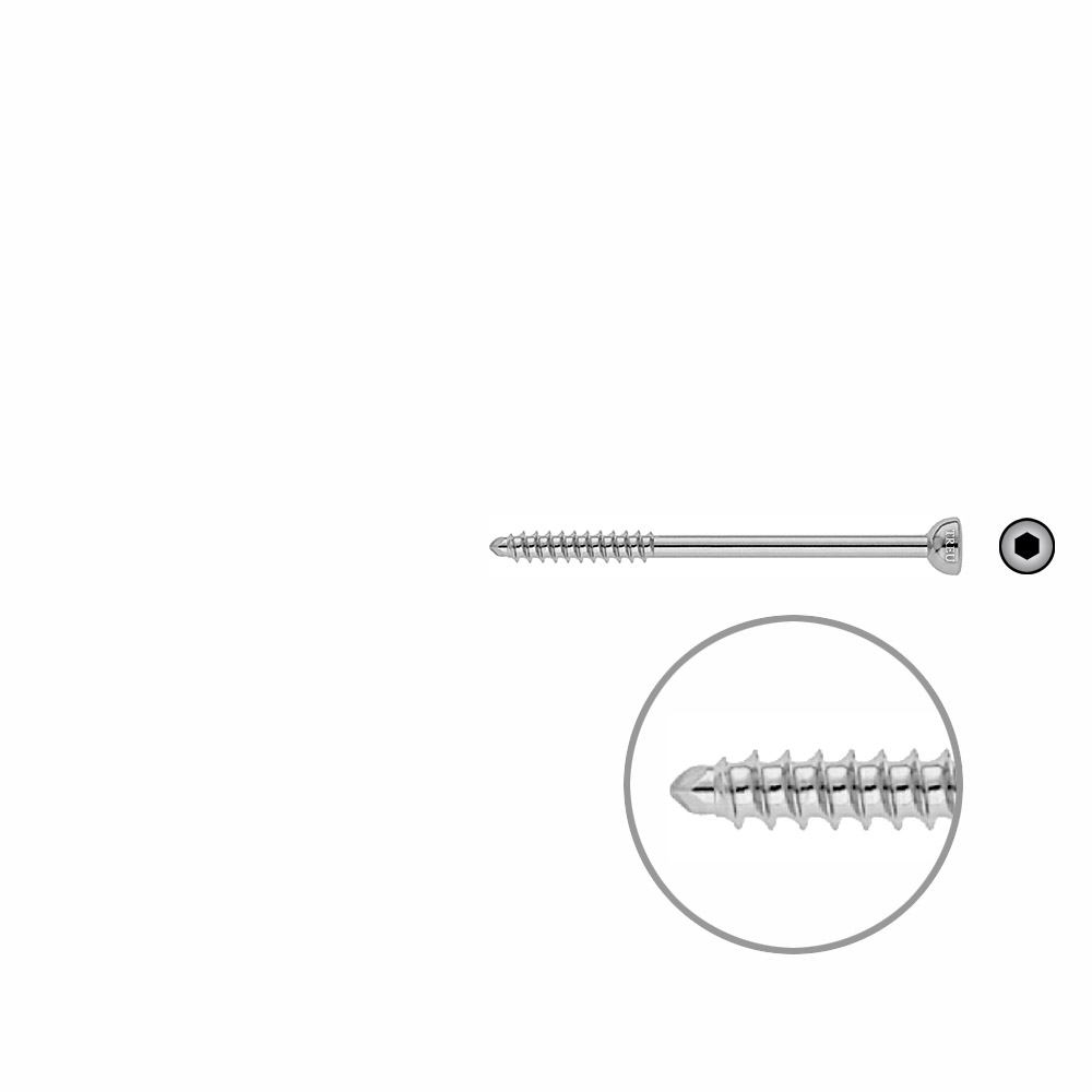 Malleolarschraube 4,5 x 65mm 