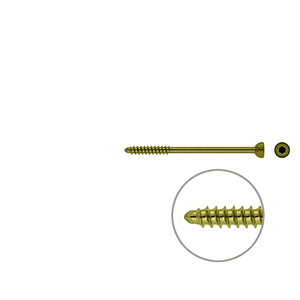 Malleolarschraube 4,5 x 70mm TITAN 