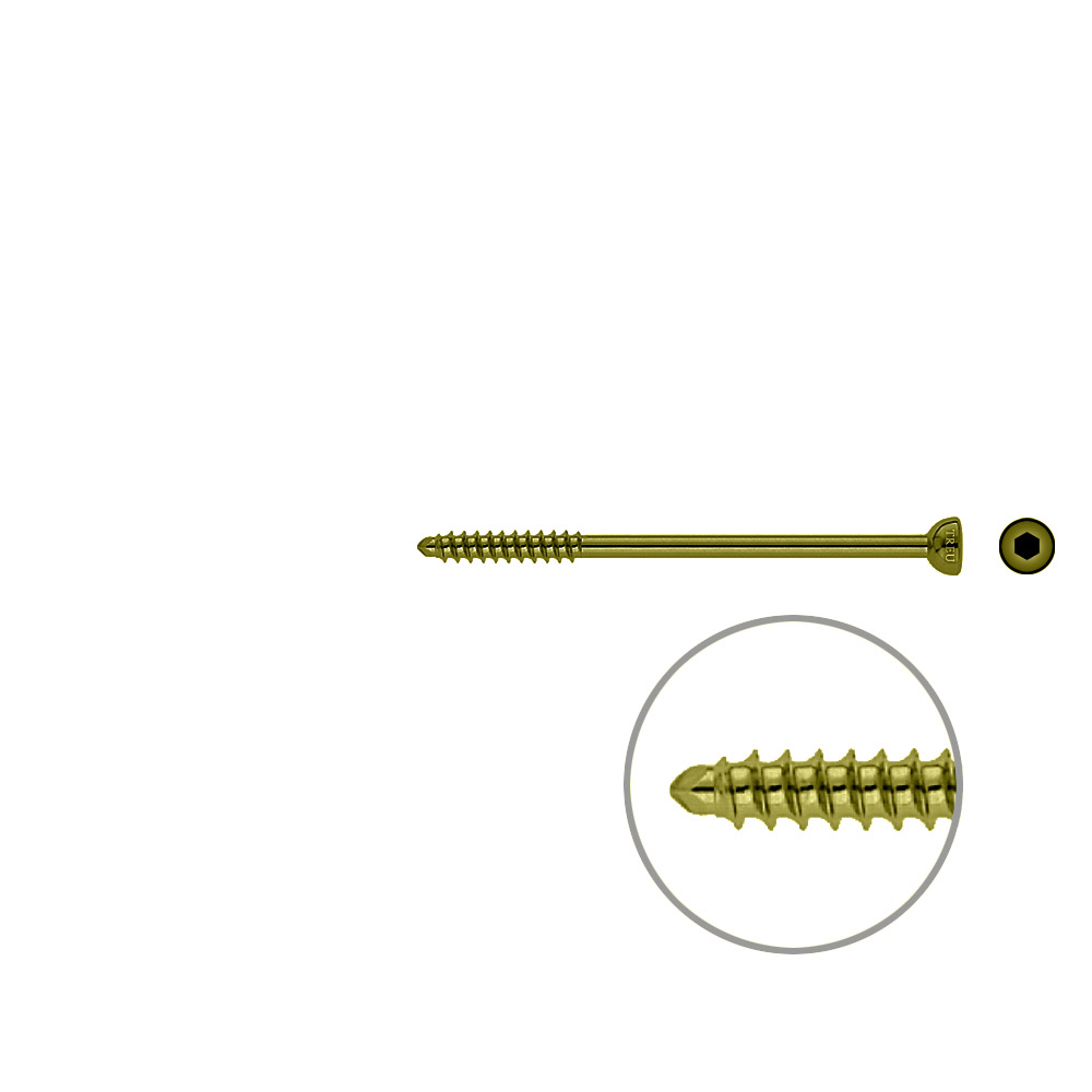 Malleolarschraube 4,5 x 75mm TITAN 