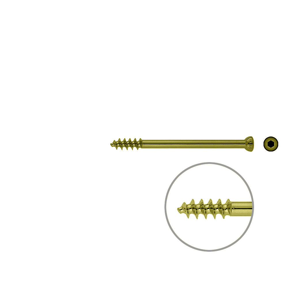 Spongiosa screw 6,5x 75mm thr. 16mm TITAN 