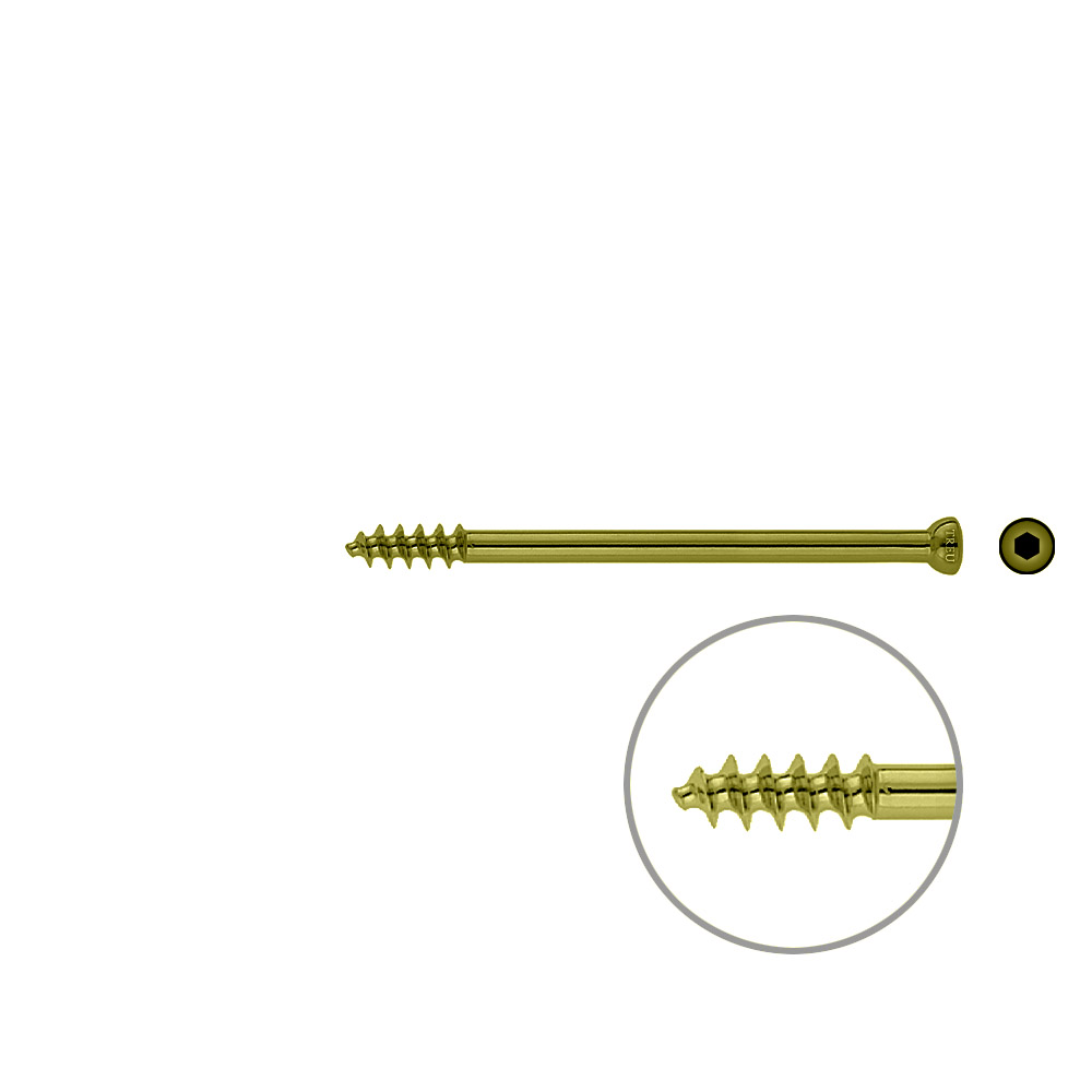 Spongiosa screw 6,5x 85mm thr. 16mm TITAN 