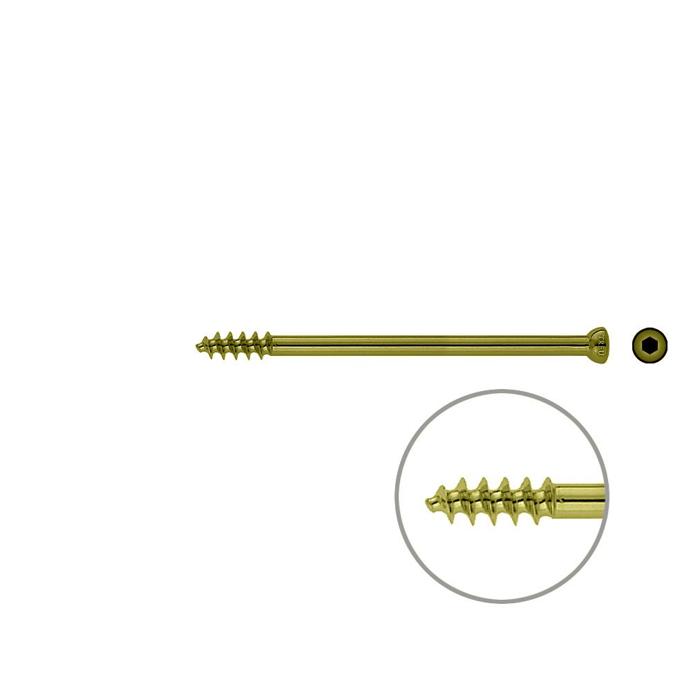 Spongiosa screw 6.5x 90mm thr. 16mm TITAN 