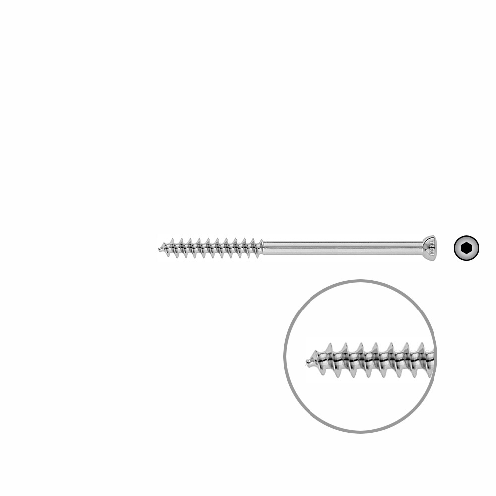 Spongiosa screw 6.5x 85mm thr. 32mm 