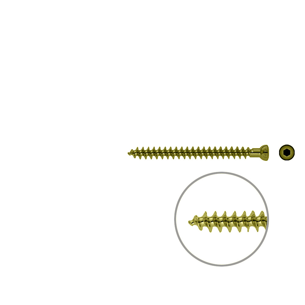 Spongiosa screw 6.5x 70mm full thr. TITAN 