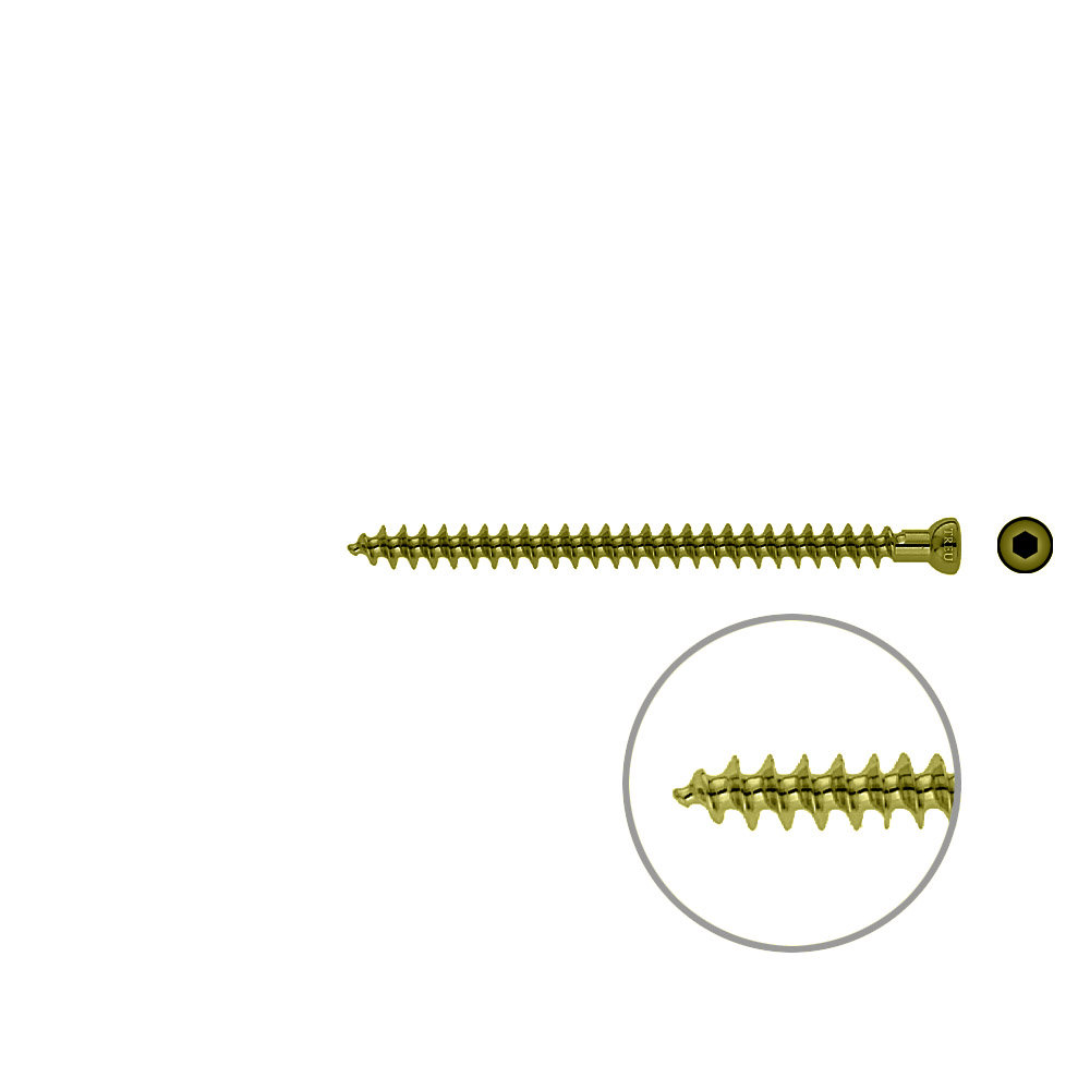 Spongiosa screw 6.5x 85mm full thr. TITAN 