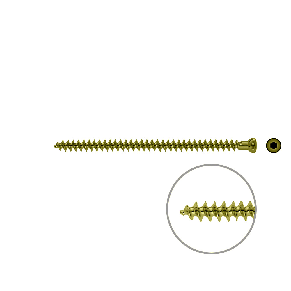 Spongiosa screw 6.5x 105mm full thr TITAN 