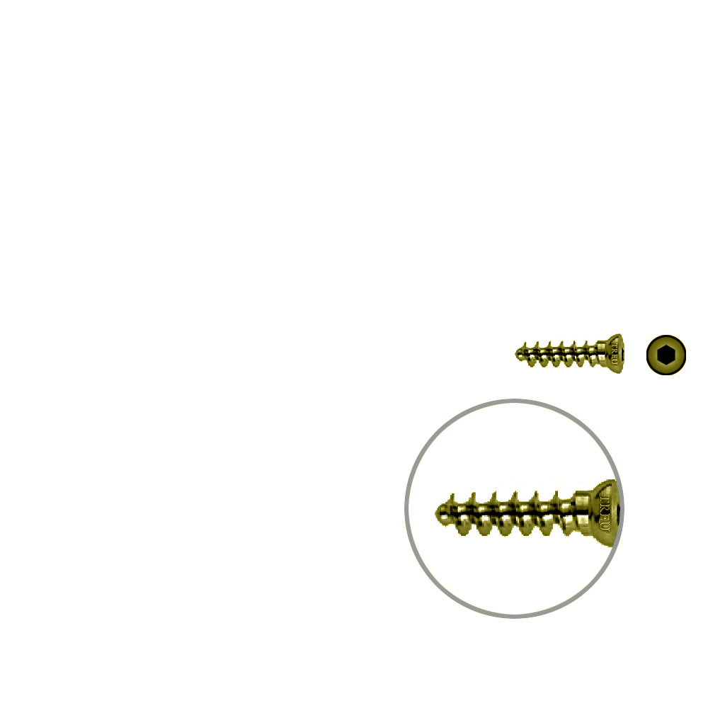 Spongiosaschraube 3,5 x 16mm TITAN 