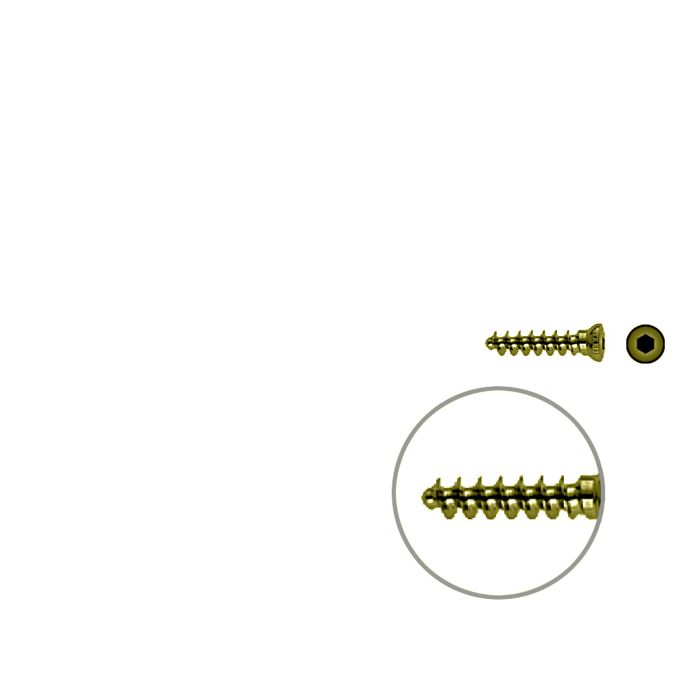 Cancellous Screw 3.5 x 18mm TITAN 