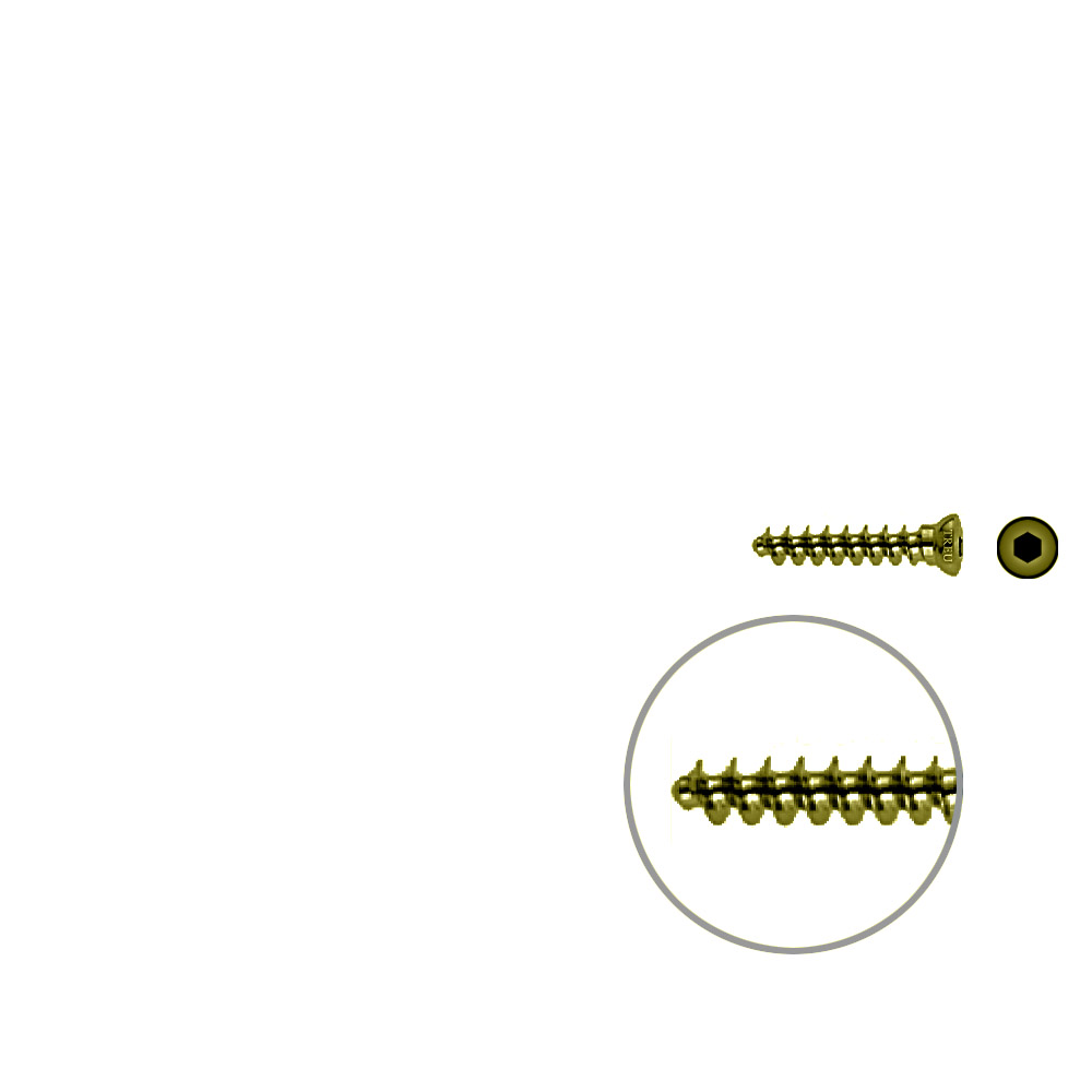 Spongiosaschraube 3,5 x 20mm TITAN 