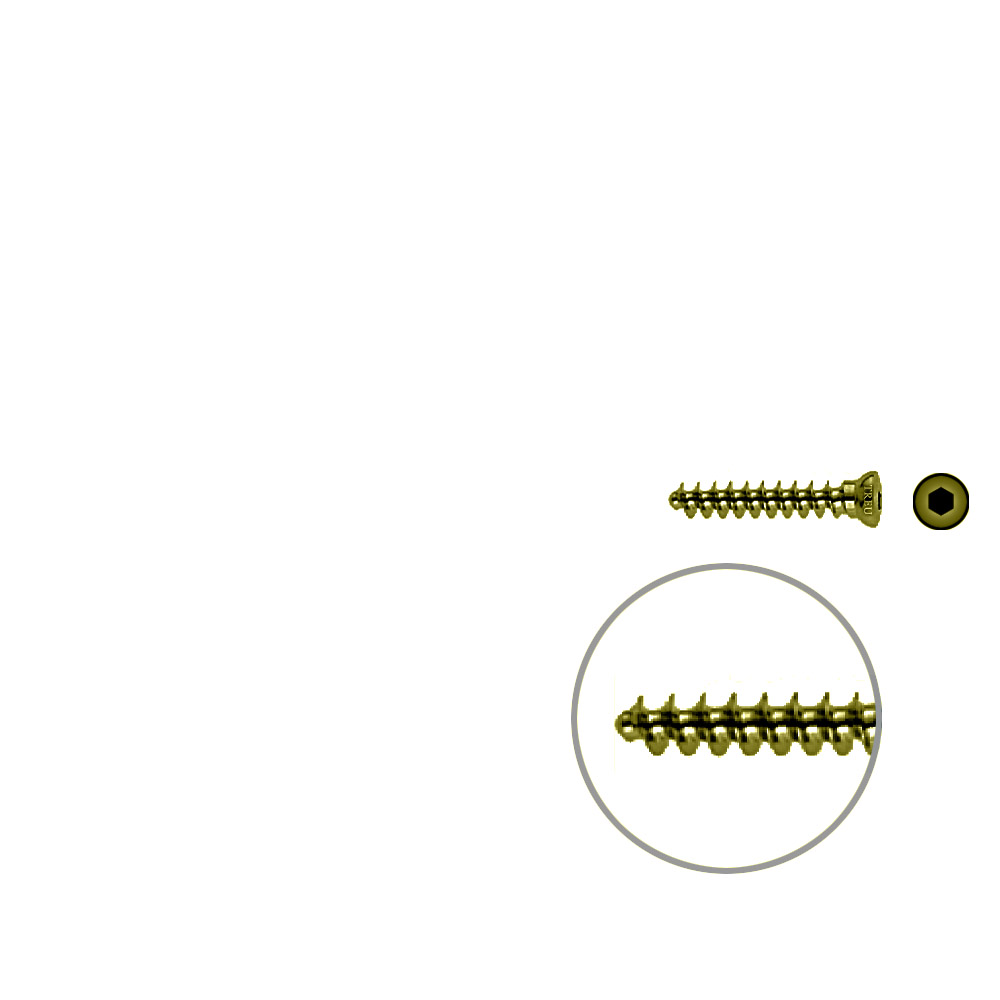 Spongiosaschraube 3,5 x 22mm TITAN 