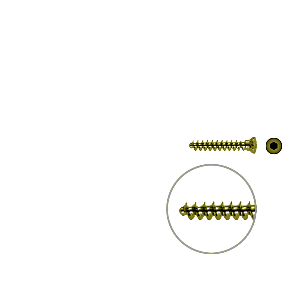 Cancellous Screw 3.5 x 24mm TITAN 