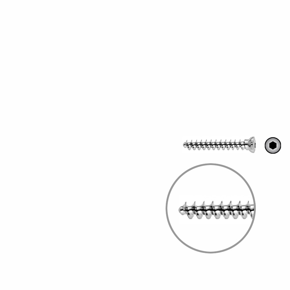 Spongiosaschraube 3,5 x 26mm 