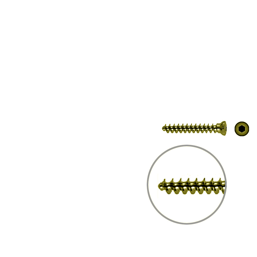 Spongiosaschraube 3,5 x 26mm TG TITAN 