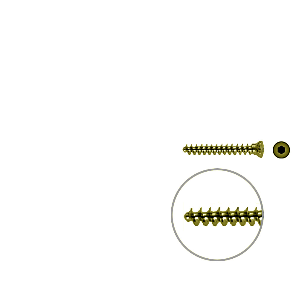 Spongiosaschraube 3,5 x 28mm TITAN 