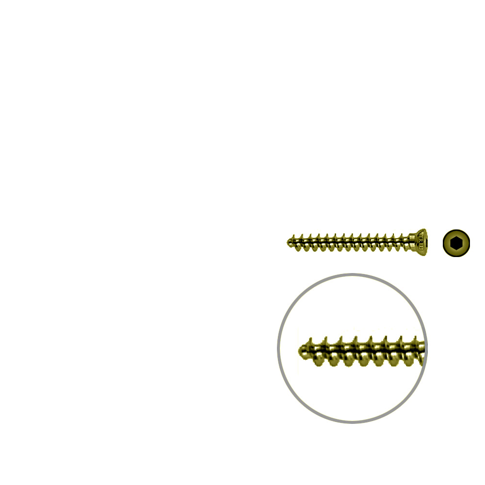 Spongiosaschraube 3,5 x 30mm TITAN 