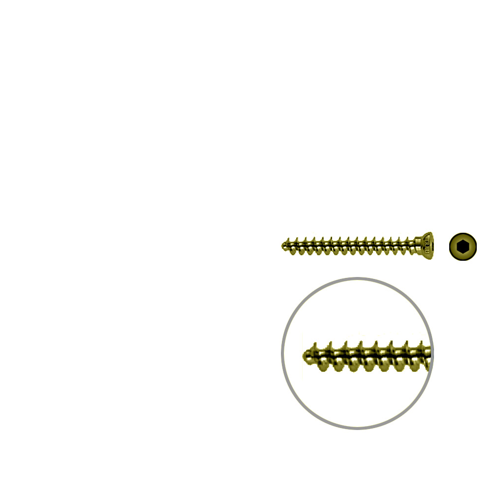 Spongiosaschraube 3,5 x 32mm TITAN 