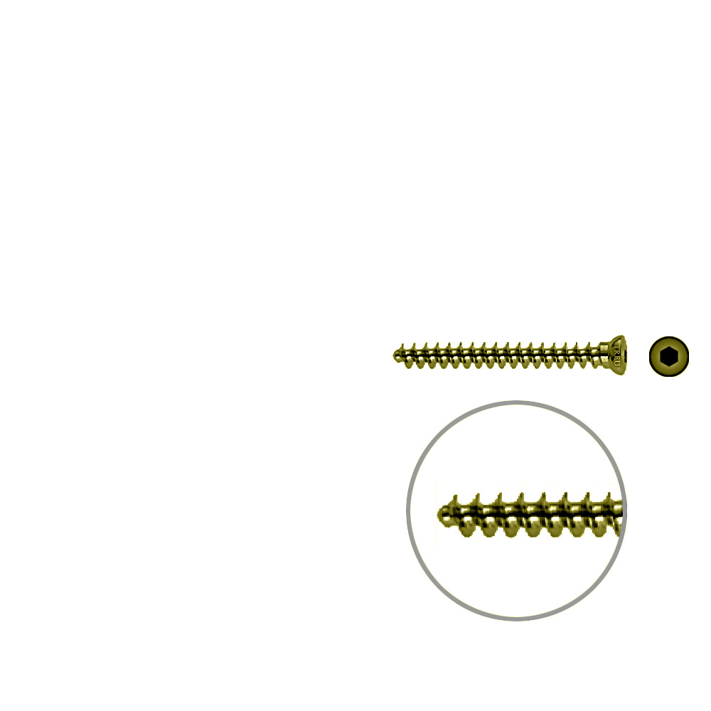 Spongiosaschraube 3,5 x 34mm TITAN 