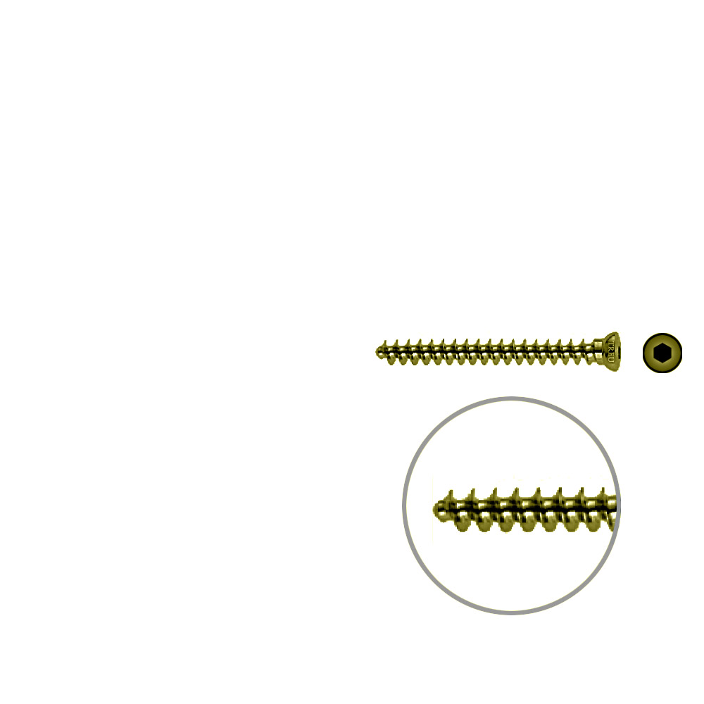 Spongiosaschraube 3,5 x 36mm TITAN 