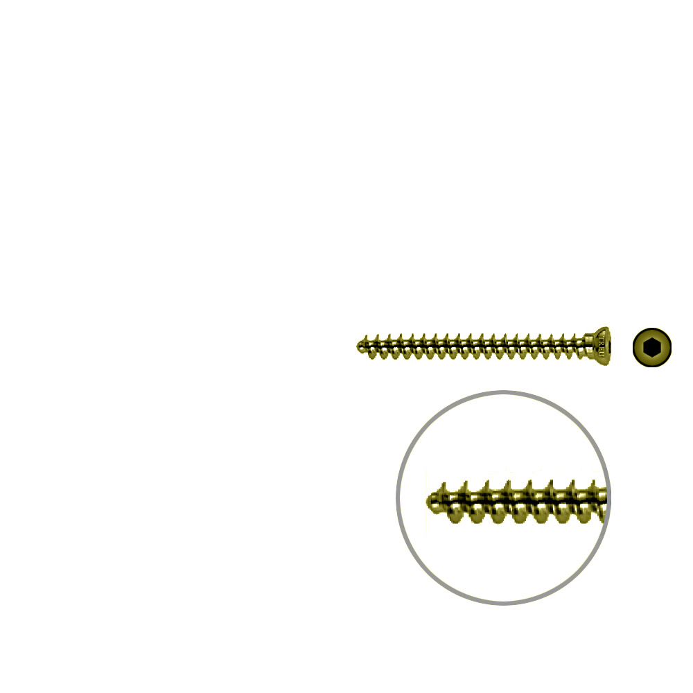 Spongiosaschraube 3,5 x 38mm TITAN 