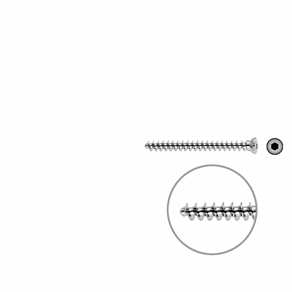 Spongiosaschraube 3,5 x 40mm 