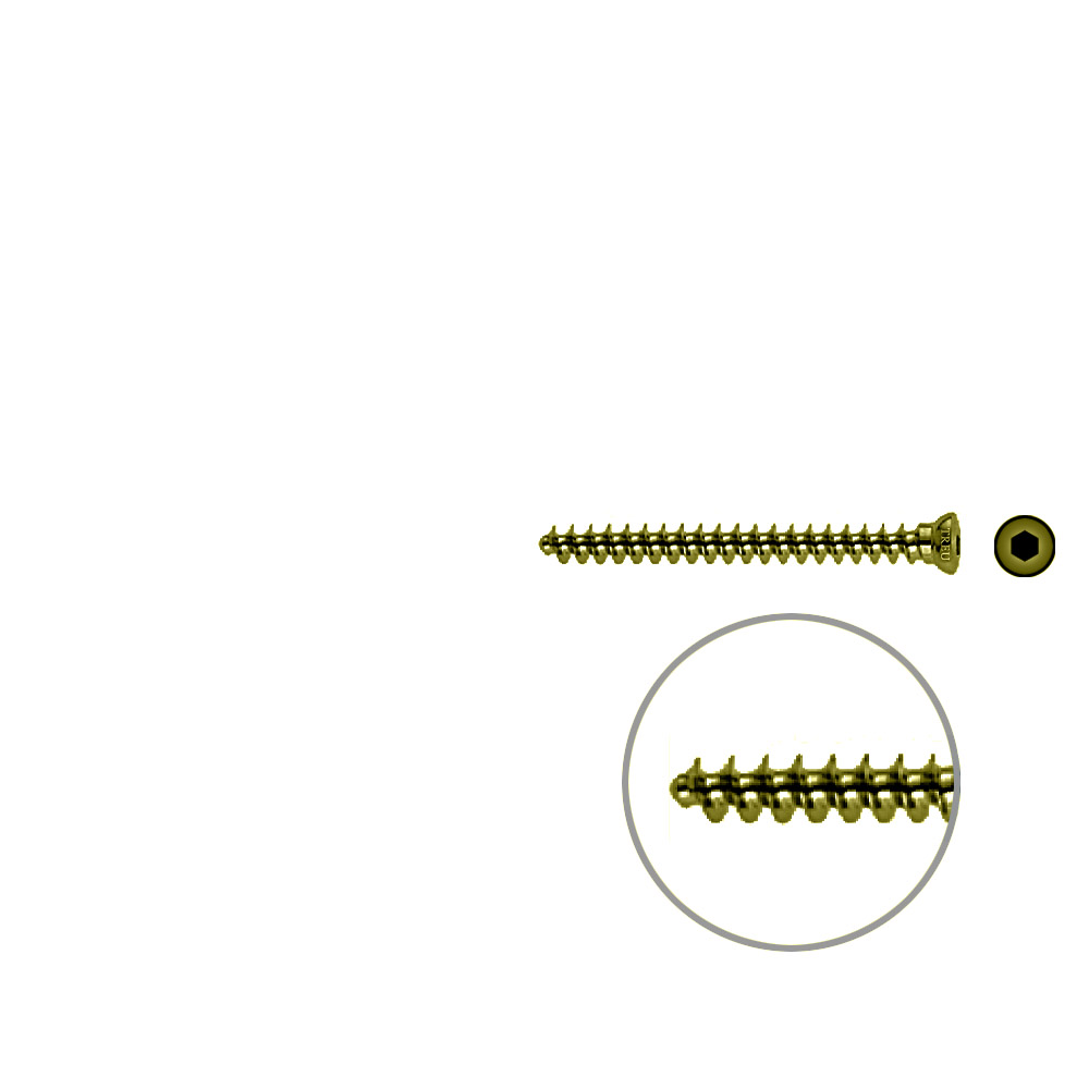 Spongiosaschraube 3,5 x 40mm TITAN 