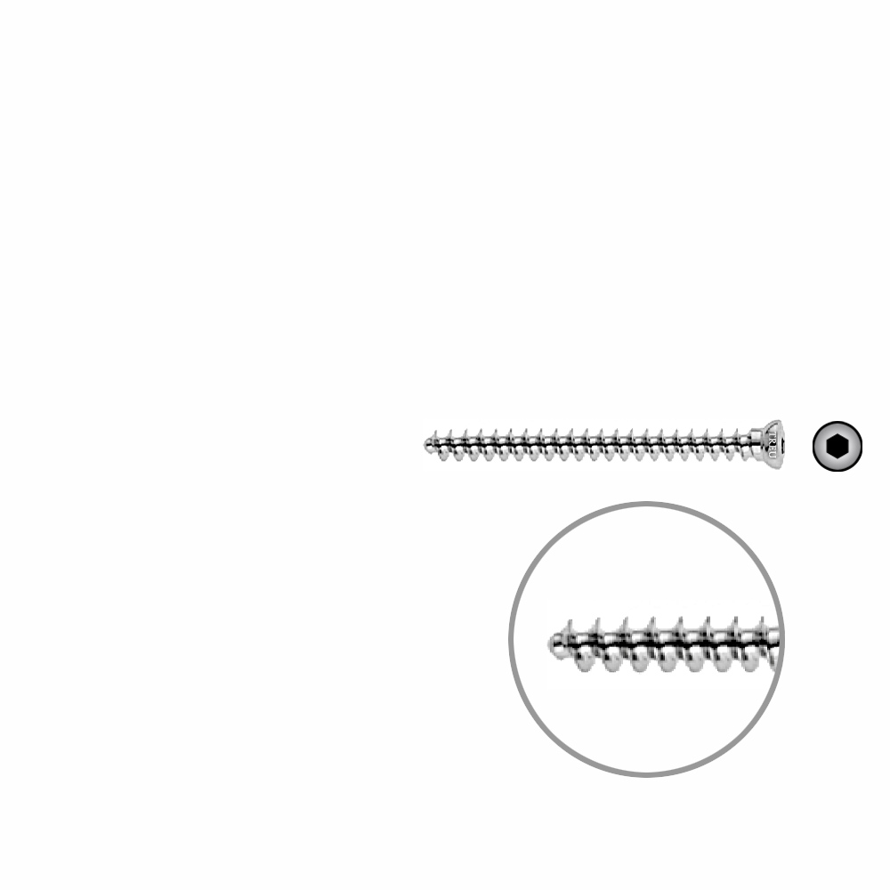 Cancellous Screw 3.5 x 42mm 