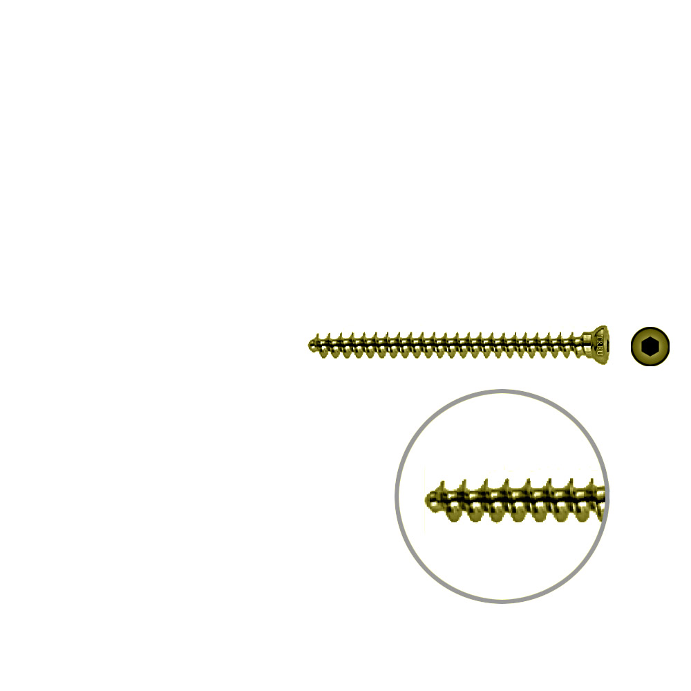 Spongiosaschraube 3,5 x 45mm TITAN 