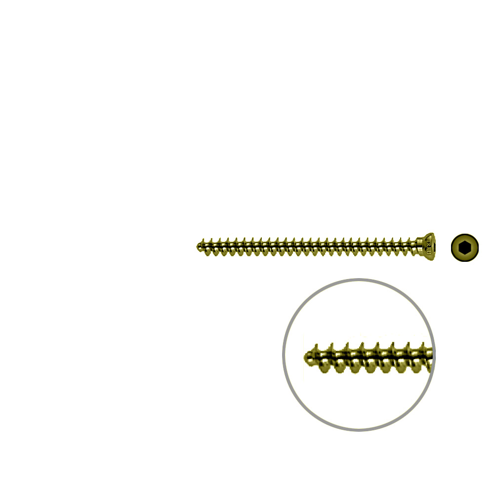 Spongiosaschraube 3,5 x 50mm TITAN 