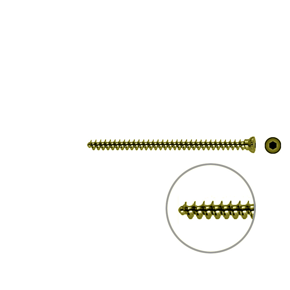 Spongiosaschraube 3,5 x 60mm TITAN 