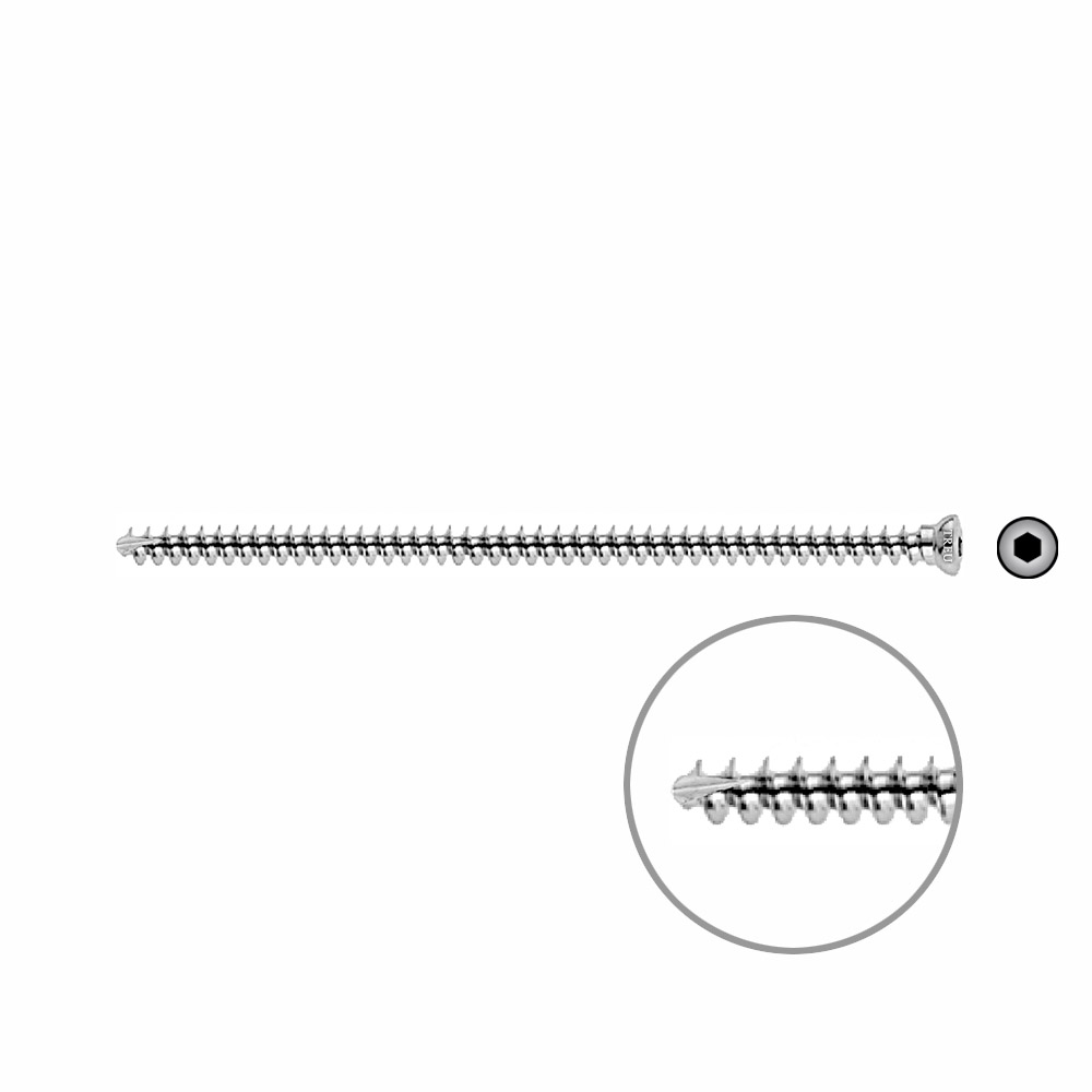 Spongiosaschraube 3,5 x 80mm selbstschneidend 