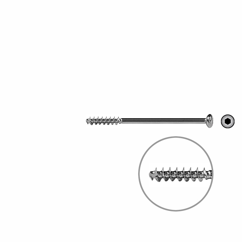 Cancellous bone screw 4mm HG 55mm 