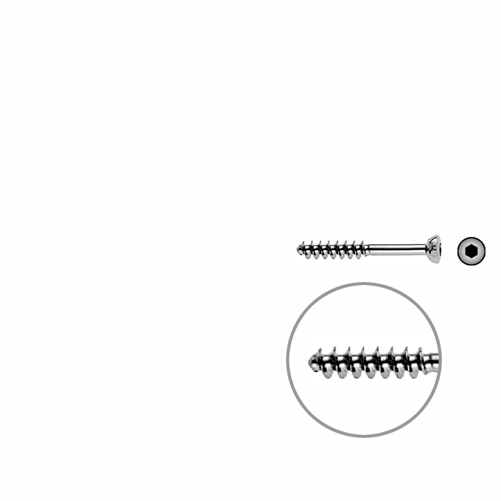 Cancellous Screw 4mm half thr. 30mm 