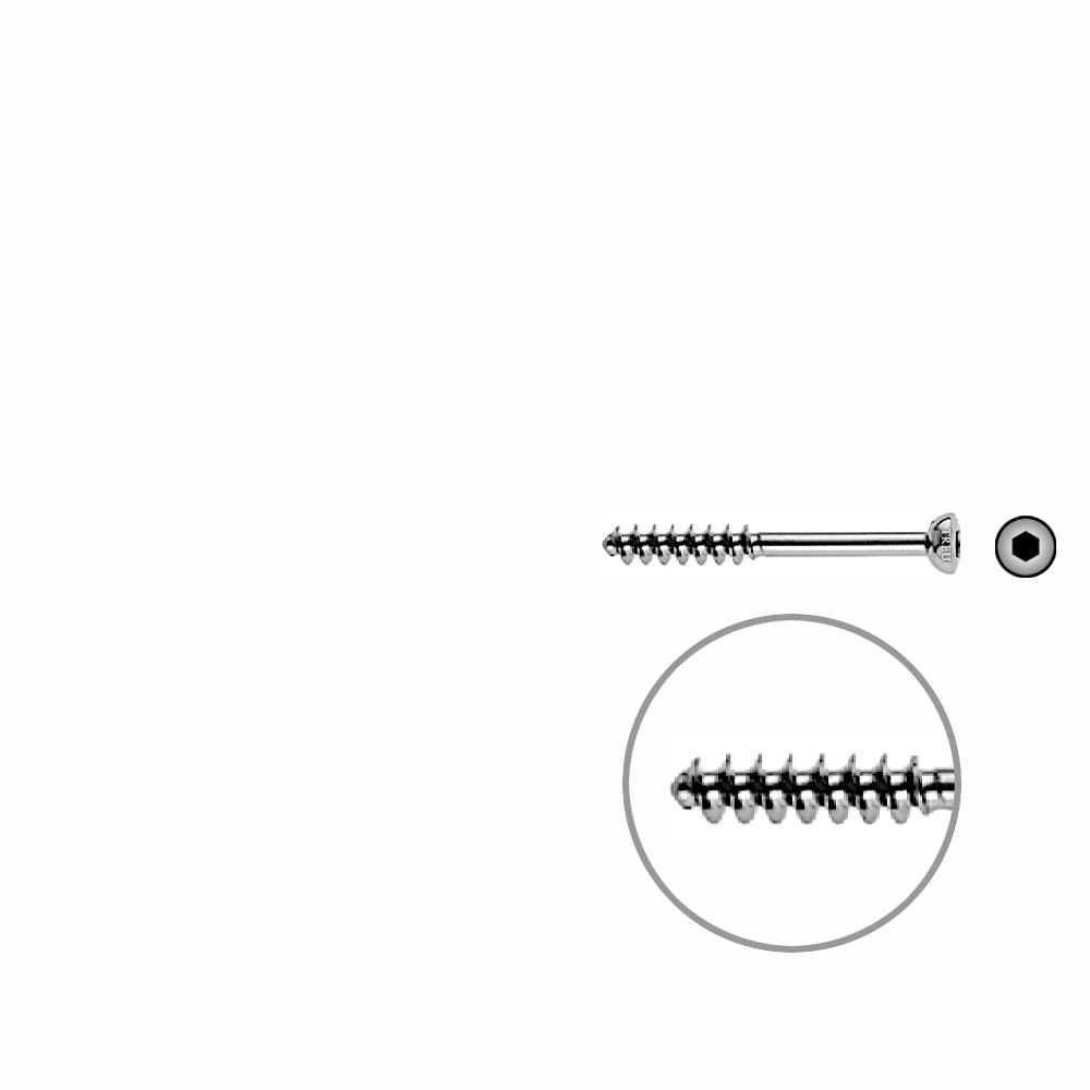 Cancellous Screw 4mm half thr. 34mm 