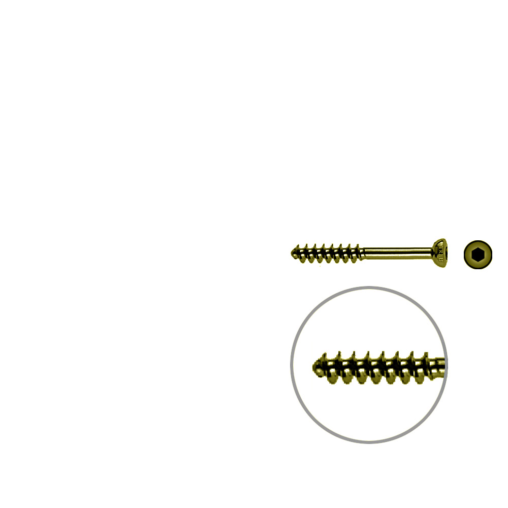 Cancellous Screw 4mm half thr. 32mm TITAN 