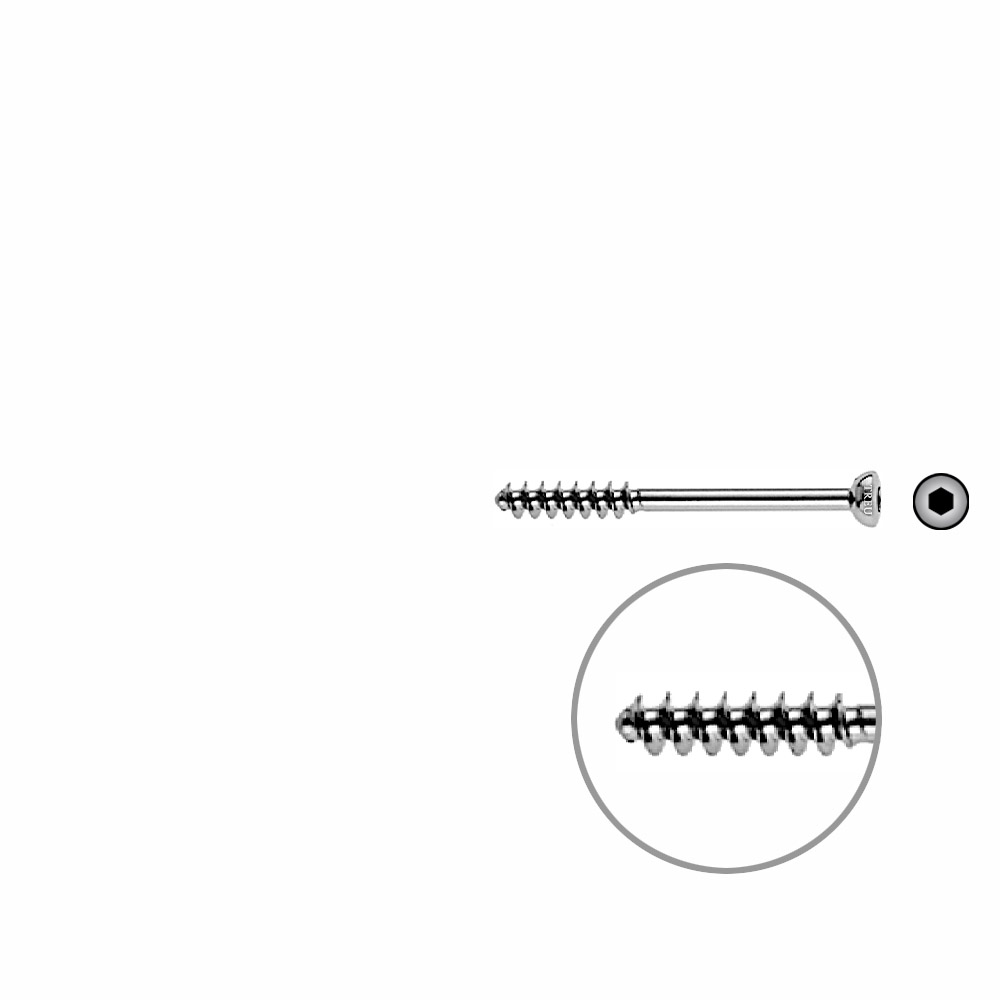 Cancellous Screw 4mm half thr. 40mm 