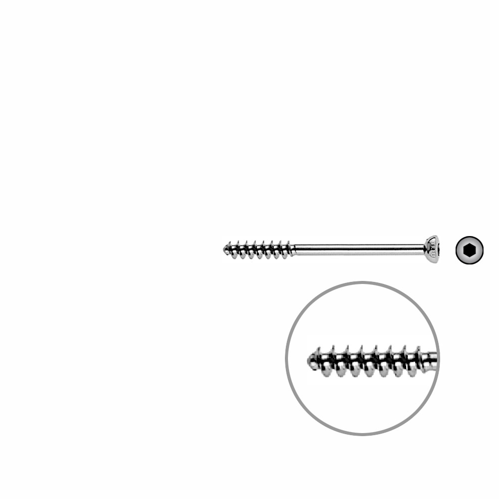 Cancellous Screw 4mm half thr. 45mm 