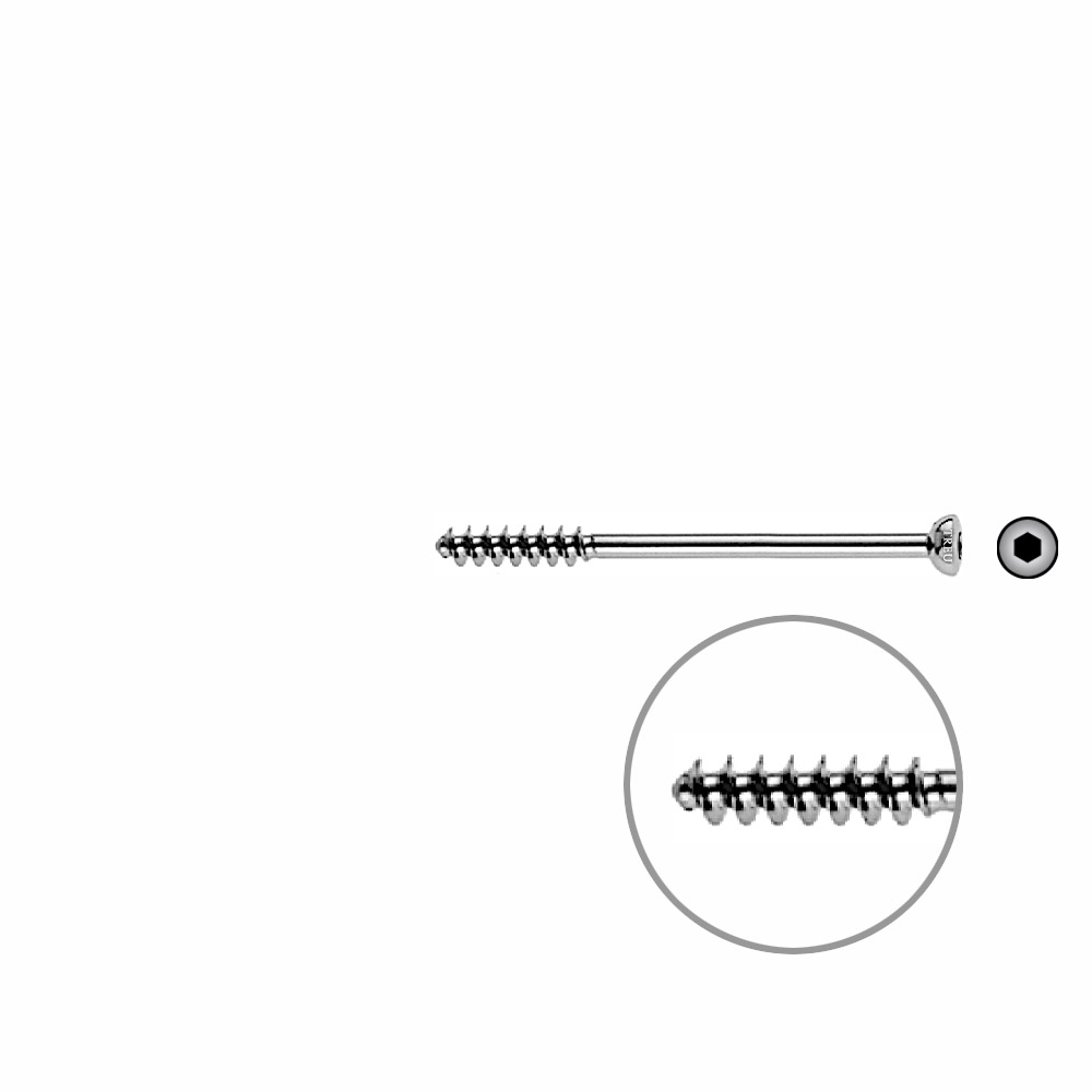 Cancellous Screw 4mm half thr. 50mm 