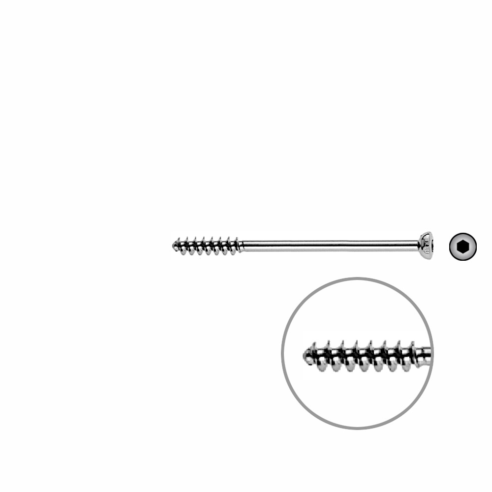 Cancellous Screw 4mm half thr. 55mm 