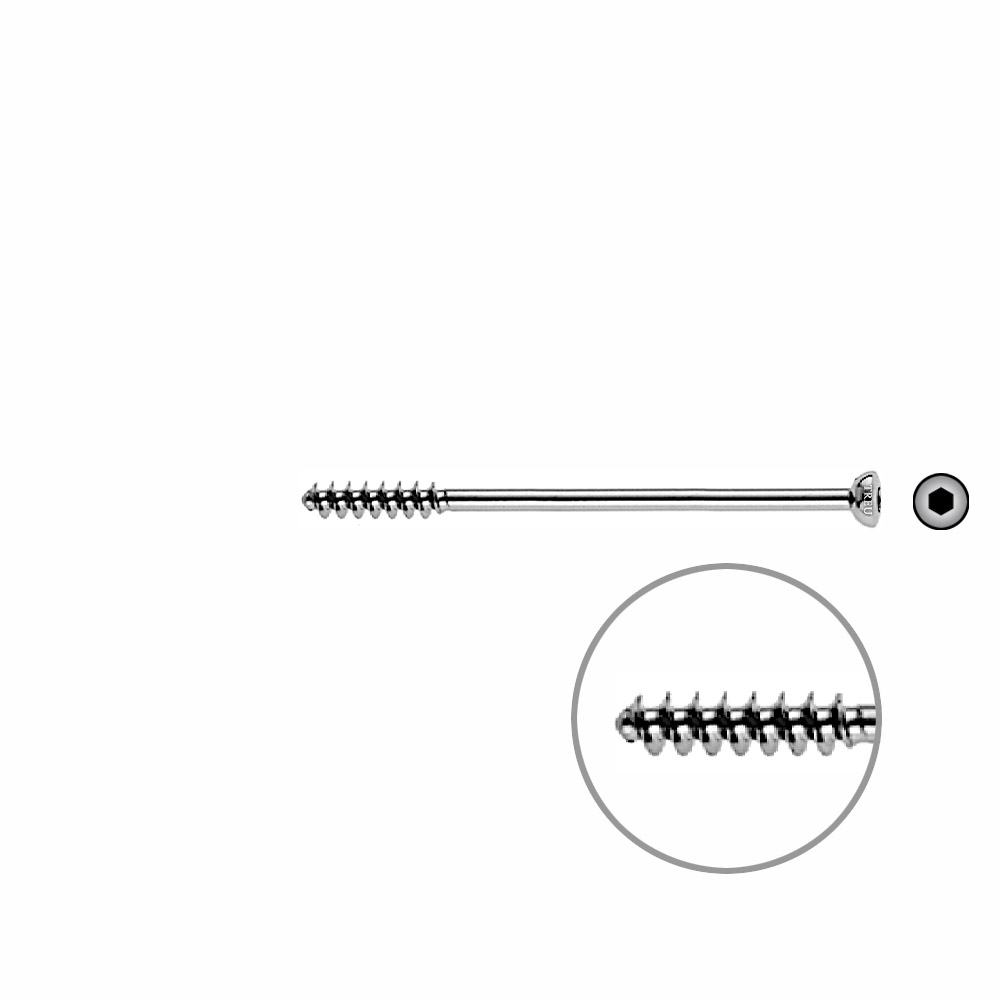 Cancellous Screw 4mm half thr. 60mm 