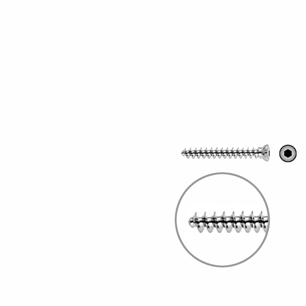 Cancellous Screw 4mm full thr. 30mm 