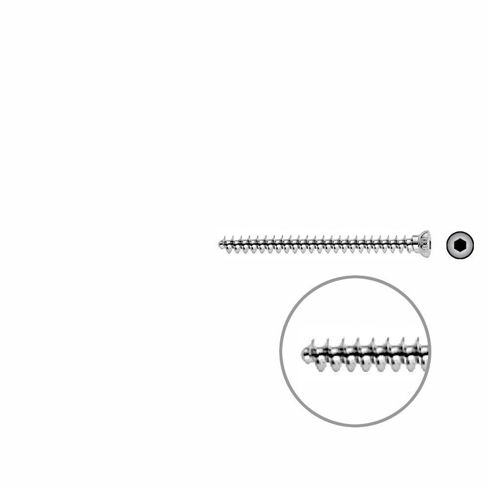 Cancellous Screw 4mm full thr. 45mm 