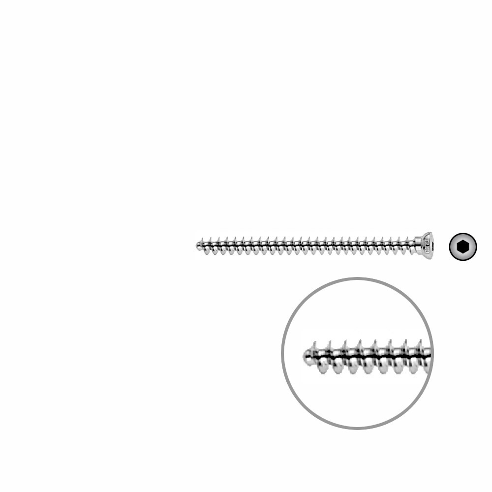 Cancellous Screw 4mm full thr. 50mm 