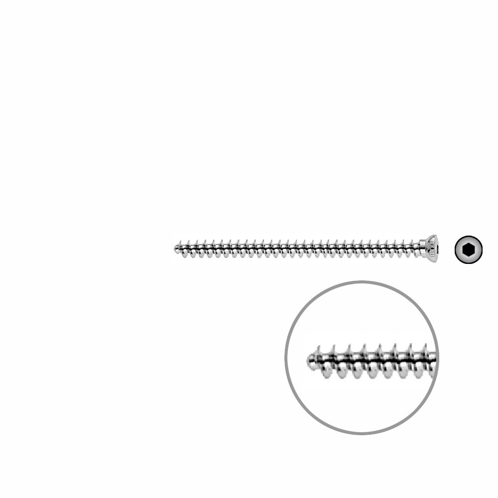 Cancellous Screw 4mm full thr.55 mm 