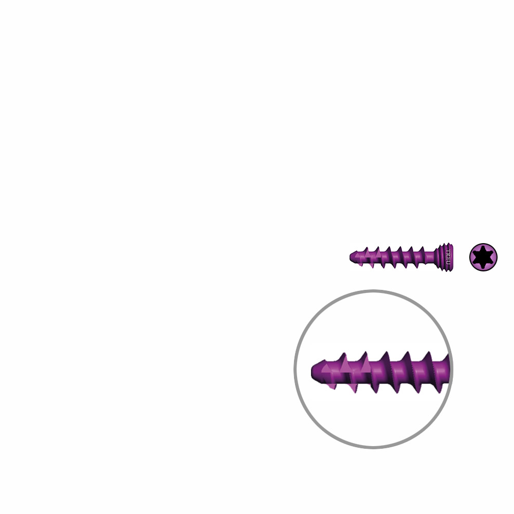 Spongiosaschraube Ø3,0mm, 14mm winkelstabil/ TI selbstschneidend 