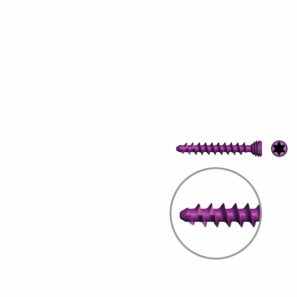 Spongiosaschraube Ø3,0mm, 20mm winkelstabil/ TI selbstschneidend 