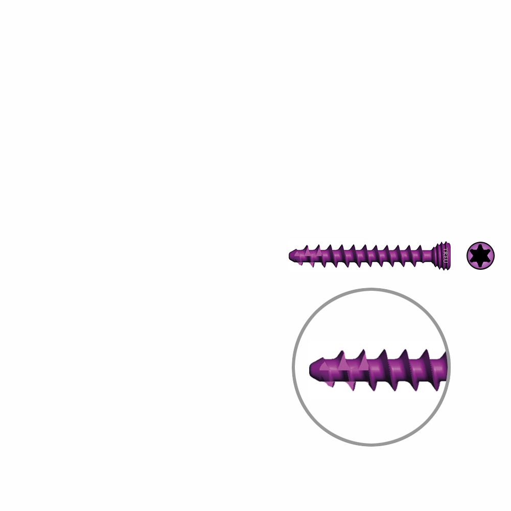 Cancel. Screws Ø 3,0mm, 22mm self-tapping angle- stable / TI 