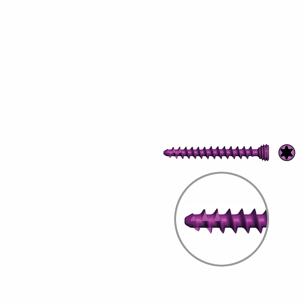 Spongiosaschraube Ø3,0mm, 24mm winkelstabil/ TI selbstschneidend 