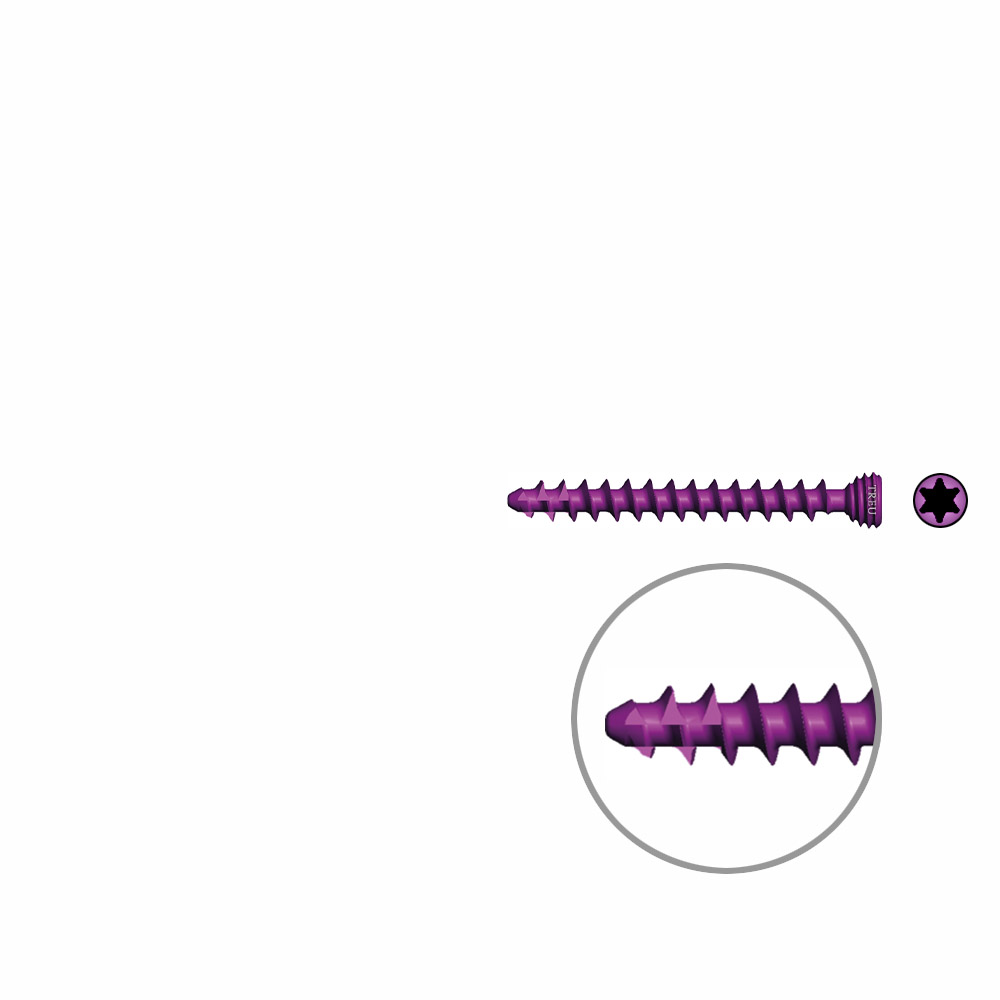 Spongiosaschraube Ø3,0mm, 26mm winkelstabil/ TI selbstschneidend 