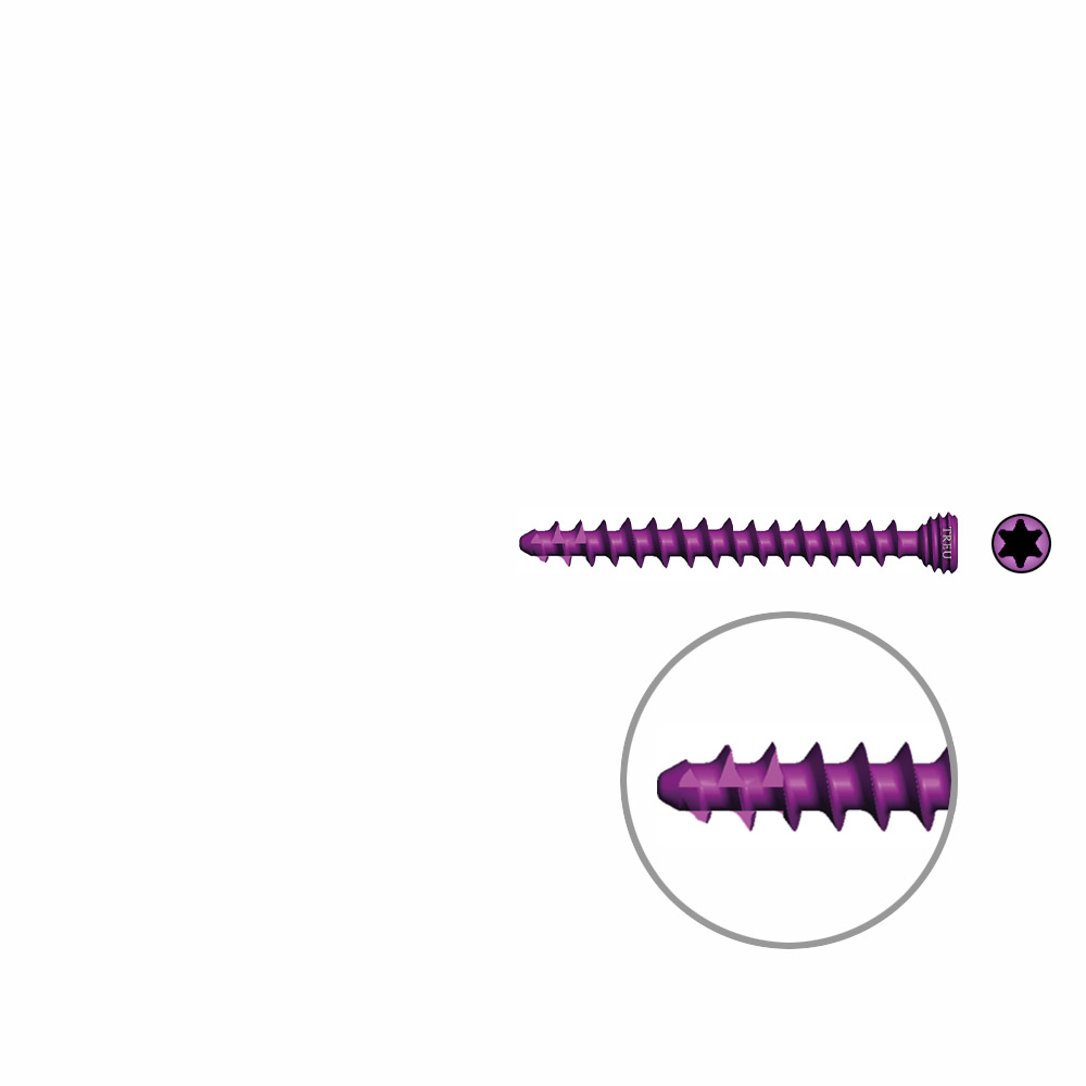 Spongiosaschraube Ø3,0mm, 28mm winkelstabil/ TI selbstschneidend 