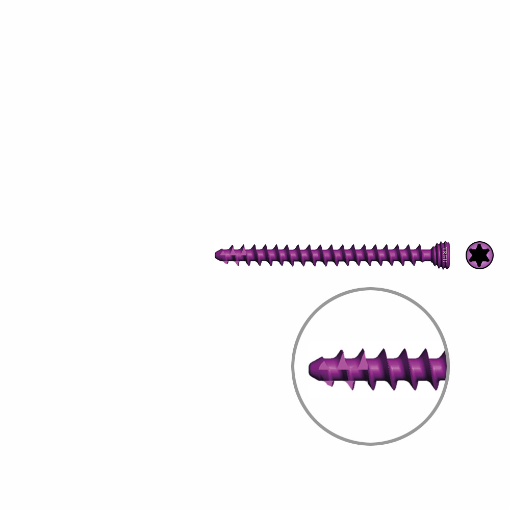 Spongiosaschraube Ø3,0mm, 32mm winkelstabil/ TI selbstschneidend 